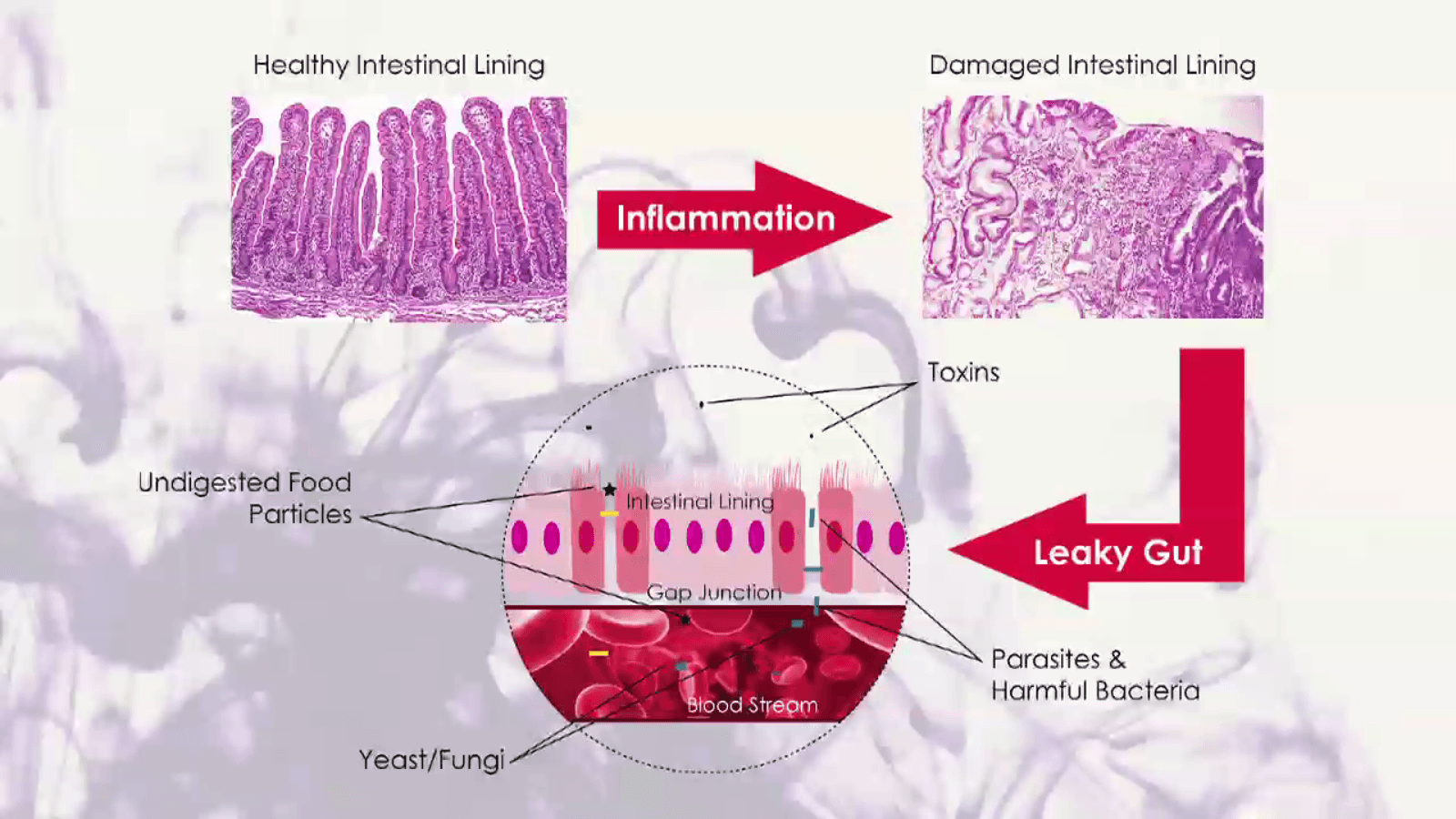 Ayurveda and Auto-Immune Diseases Platinum Experience Ayurveda